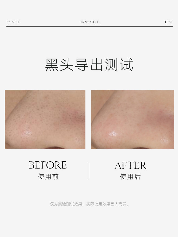 UNNY BLACKHEAD CLEAR NOSE PACK